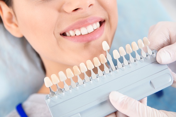 Surprising Benefits Of Dental Veneers You Did Not Know