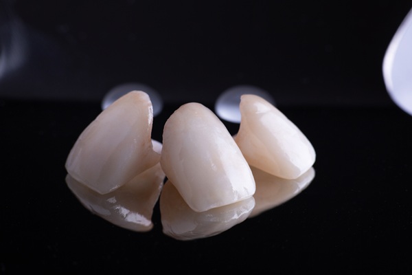 Same Day Crowns: How You Can Restore Your Smile In A Single Visit