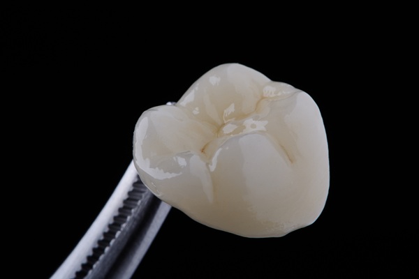 A Complete Guide To Same Day Crowns: What Patients Should Know